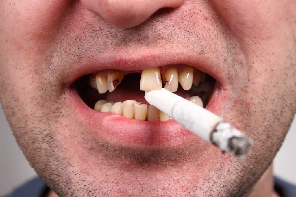 از بین بردن بوی سیگار از نفس |از بین بردن بوی سیگار دهان فوری