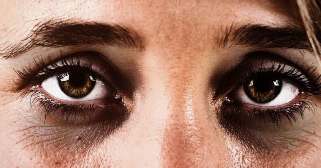 درمان سریع سیاهی دور چشم |رفع تیرگی دور چشم در سه روز