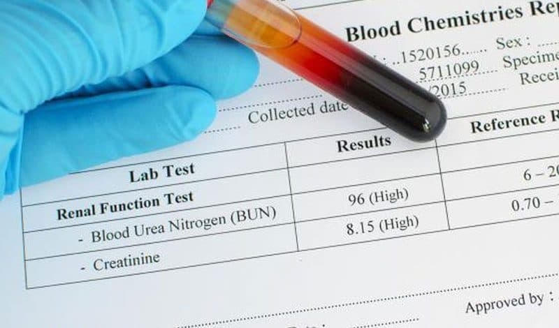 بالا بودن urea در آزمایش خون نی نی سایت |برای کاهش اوره چه بخوریم