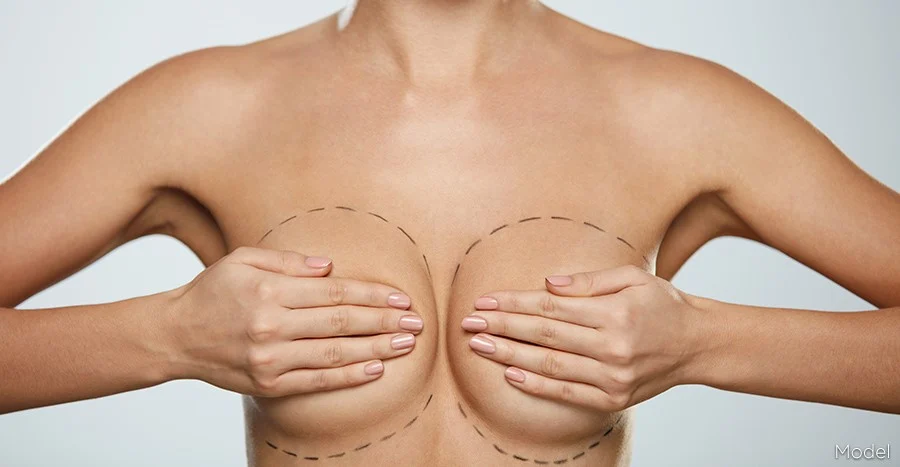 How is the breast prosthesis operation?