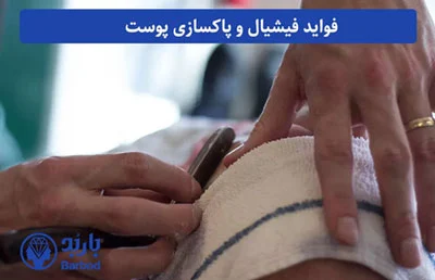 پوست |تهران