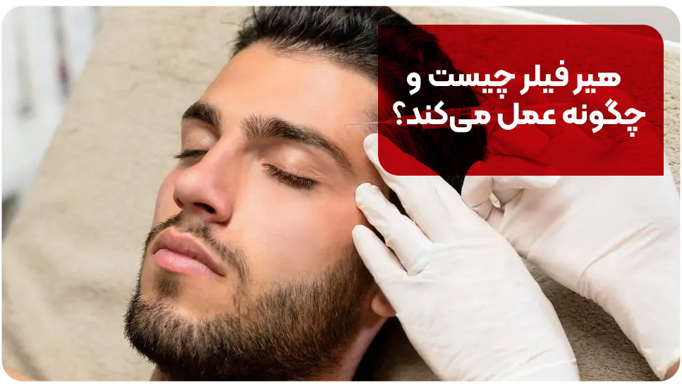 هیر فیلر چیست و چگونه عمل می‌کند؟